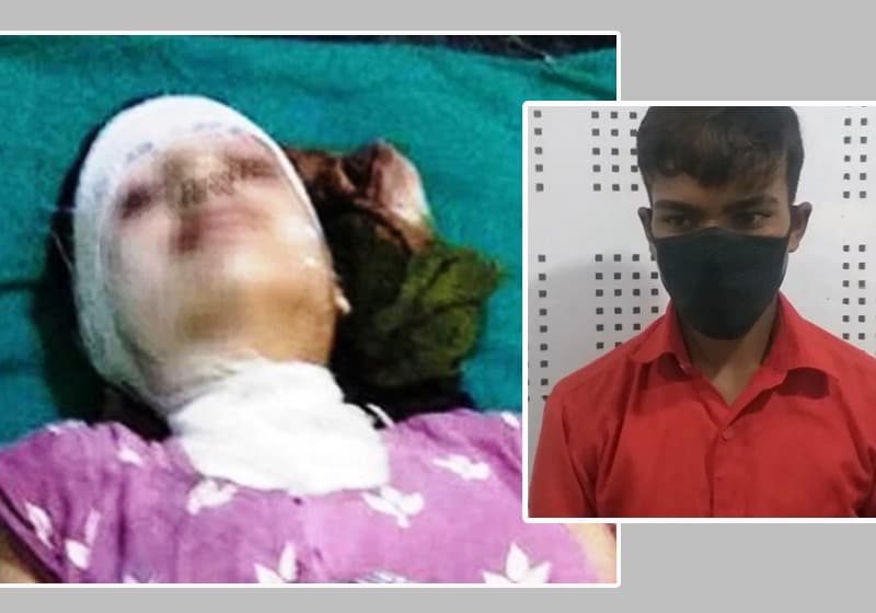 वीरगञ्जमा १५ वर्षीया छात्रामाथि एसिड प्रहार, उपचारका लागि काठमाडौं लगिँदै